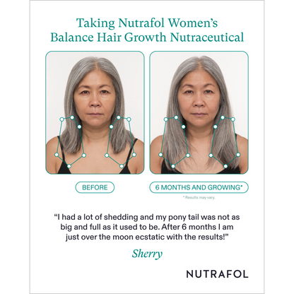 A before and after of a woman using Nutrafol age 45 or older