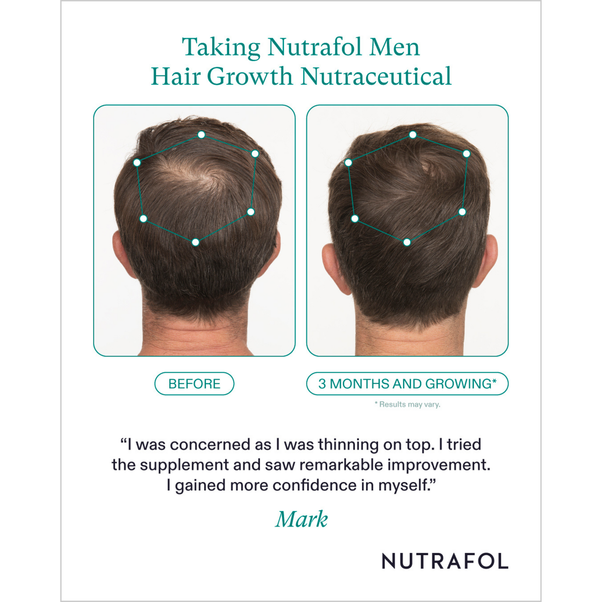 A before and after of a man using Nutrafol