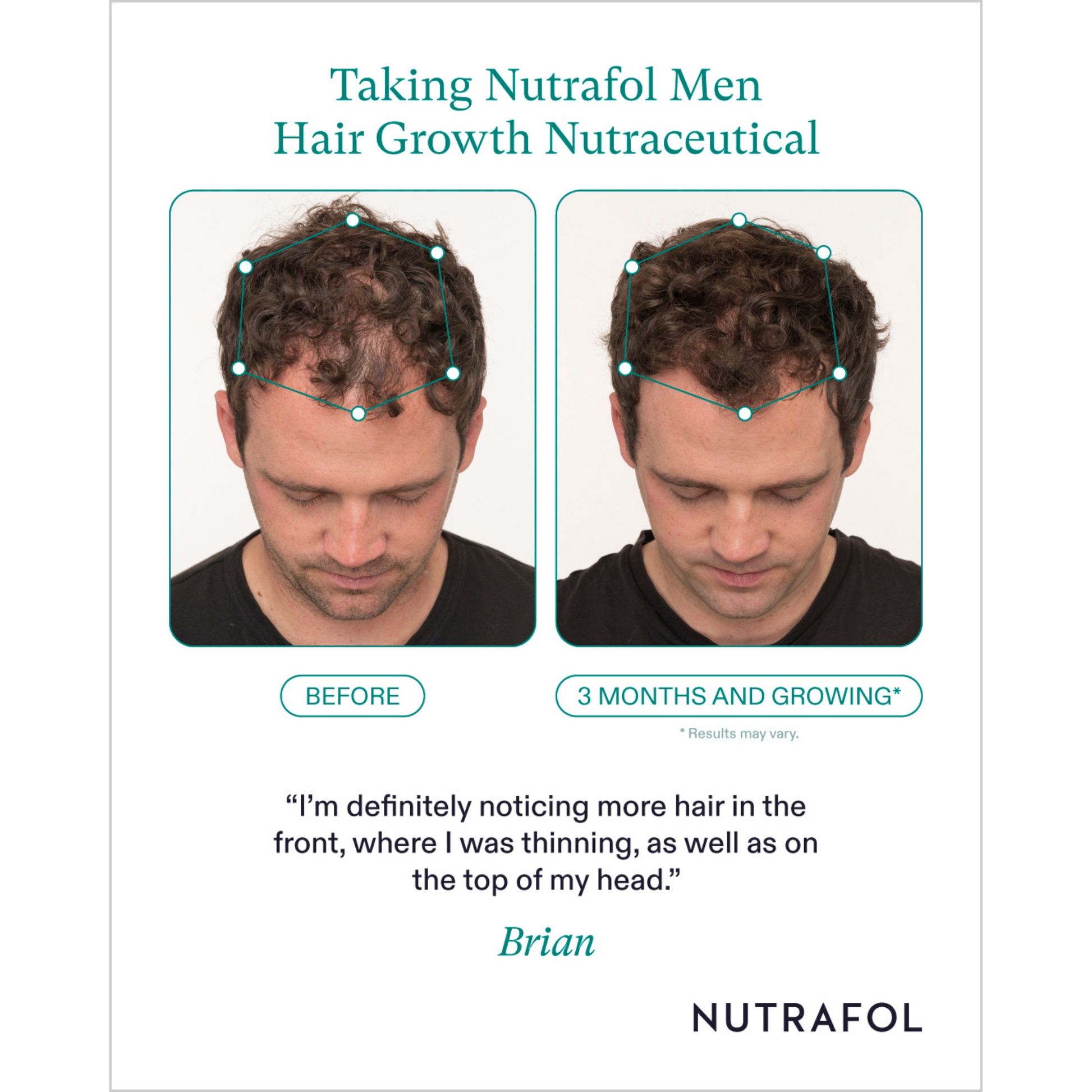 A before and after of a man's hair using Nutrafol