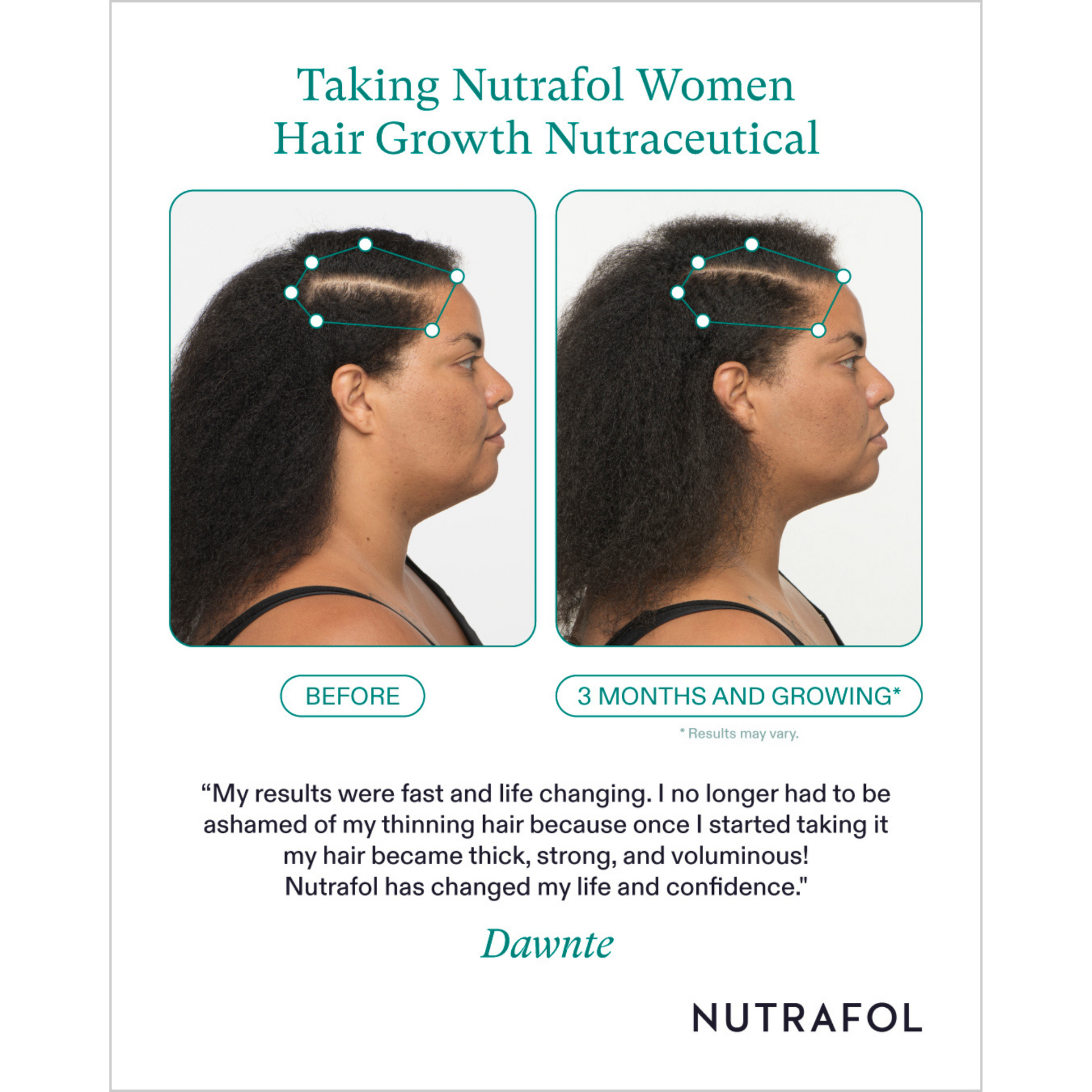 A before and after of a woman using Nutrafol